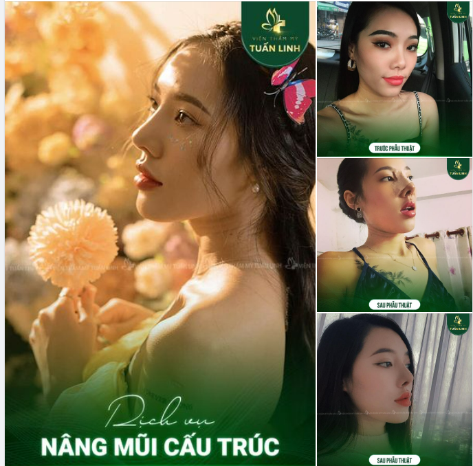THAY DÁNG MŨI - ĐỔI KHUÔN MẶT