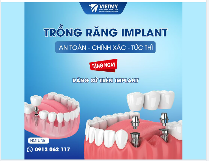 NHA KHOA QUỐC TẾ VIỆT MỸ - LỰA CHỌN TIN CẬY ĐỂ TRỒNG RĂNG IMPLANT
