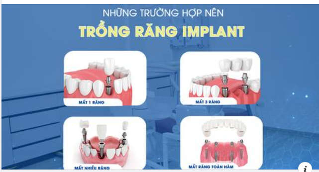 Một hàm răng chắc khỏe, trắng sáng sẽ khiến cho mỗi người trở nên tự tin hơn. Với sự phát triển hiện đại của công nghệ y tế đã cho ra đời nhiều loại dịch vụ thẩm mỹ cho răng hiệu quả.