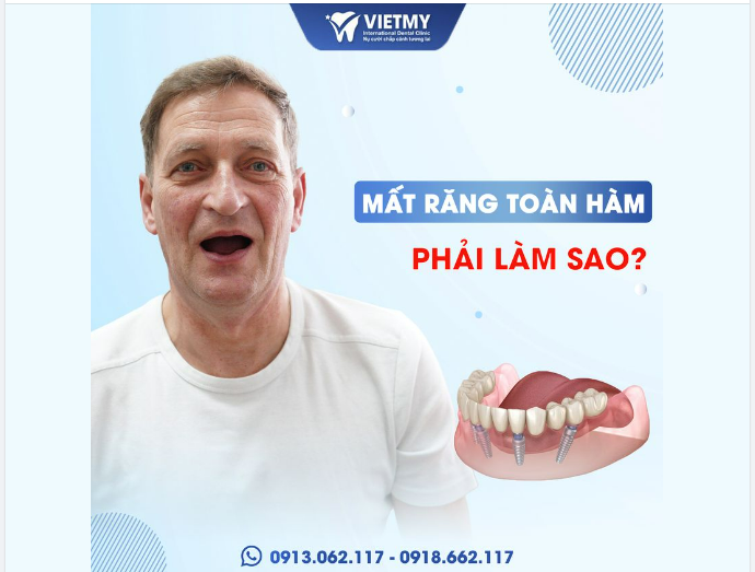 Nỗi sợ với mất răng toàn hàm, ám ảnh với chiếc hàm tháo lắp lỏng lẻo