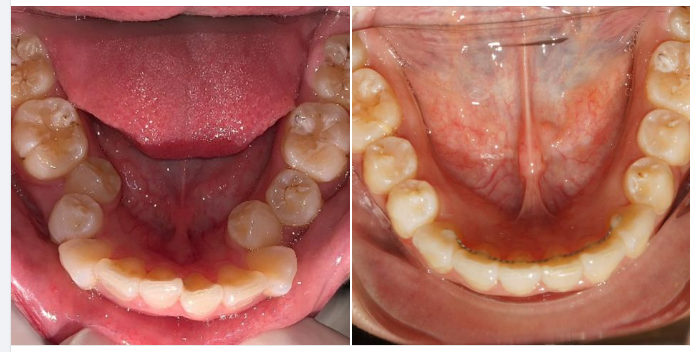 Hồi xưa nhìn hình liếc cái là kêu phải nhổ răng liền…