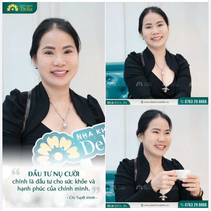 Phụ nữ hiện đại: làm mới bản thân bằng cách tự thưởng cho mình nụ cười mới thật rạng rỡ