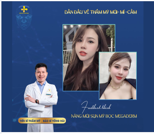 PHẢI LÀM THẾ NÀO NẾU BẢN TH N SỞ HỮU GÓC NGHIÊNG “KÉM SẮC”?