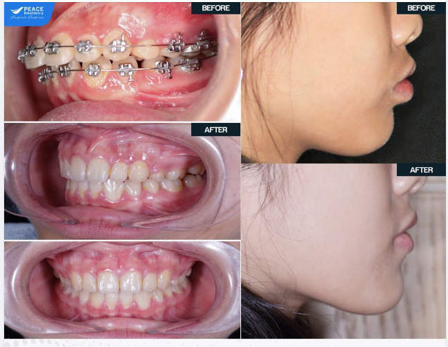 NHỮNG ĐIỀU TỐT ĐẸP THÌ LUÔN CẦN THỜI GIAN