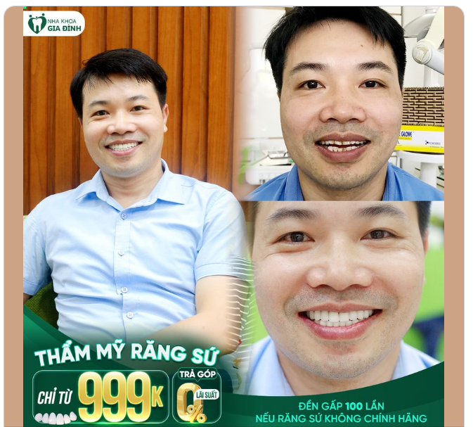 AI CŨNG PHẢI BẤT NGỜ VỀ HÀM RĂNG MỚI CỦA ANH ẤY