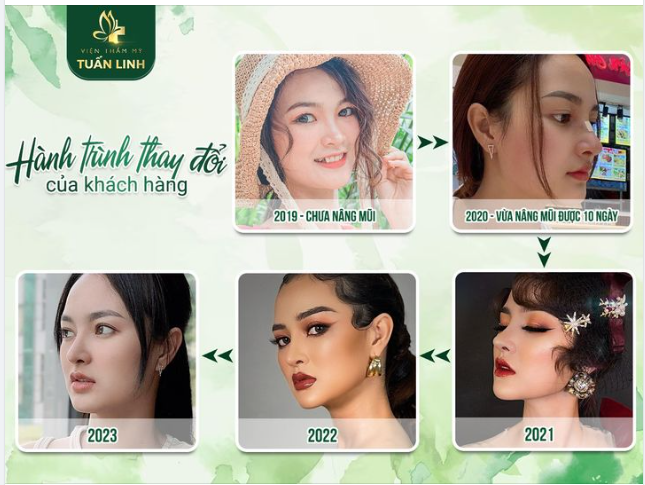 Xinh đẹp, thanh tú, thần thái cuốn hút hơn sau nâng mũi. Một sự thay đổi ''đáng tiền'' đúng không ạ?