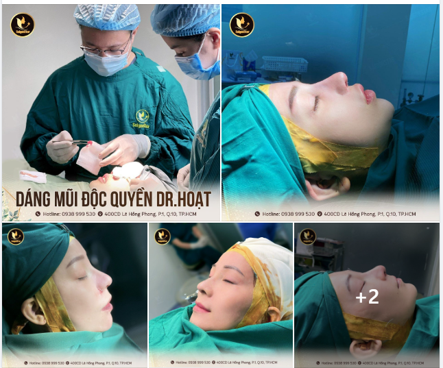 “Em muốn chiếc mũi cao thẳng tắp luôn” “Bác làm cho em cái đầu mũi bay hết mức có thể đi ạ” “Mũi càng cao em càng thích”