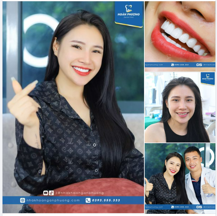Nụ cười đúng là thứ trang sức lấp lánh và đắt giá nhất của người phụ nữ. Nhìn sự thay đổi của chị Thu Huyền sau 3 ngày đến bản thân chị cũng phải WOW.