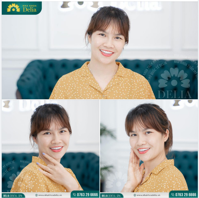 Sức lan toả của nụ cười là vô hạn. Thật vậy, một nụ cười tràn rạng rỡ và tự tin hoàn toàn có thể lan tỏa cảm hứng, niềm vui và sự lạc quan với mọi người xung quanh, giúp chúng ta gặp nhiều thuận lợi hơn trong mọi mối quan hệ và công việc.