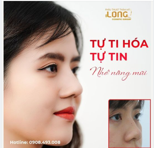 2 ĐIỀU KHIẾN KHÁCH HÀNG HỐI HẬN SAU KHI NÂNG MŨI ÍT AI BIẾT