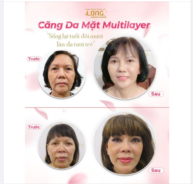 MẤT 60 PHÚT ĐÁNH ĐỔI CẢ MỘT TRỜI “THANH XUÂN”