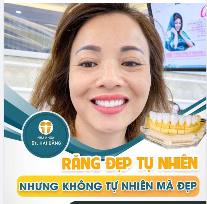 RĂNG TRẮNG SÁNG NẮNG CHÓI CHANG
