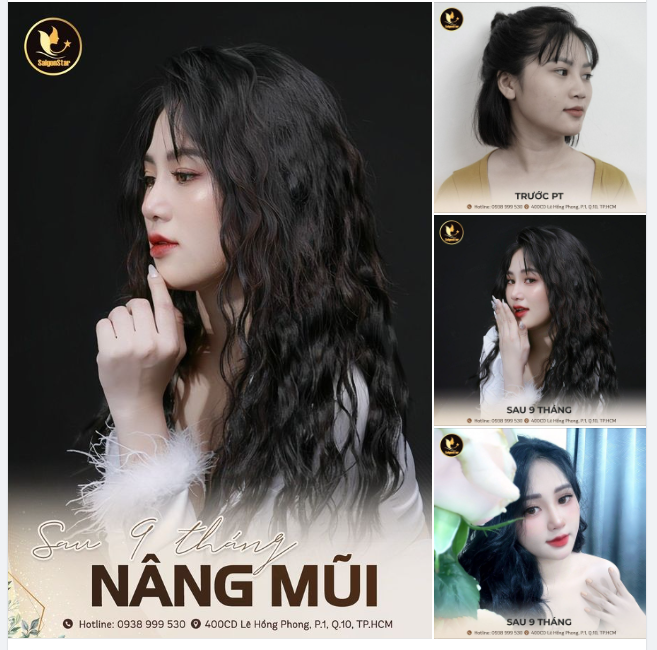 “Nhả vía” mũi đẹp cho chị em nhà Dr. Hoạt