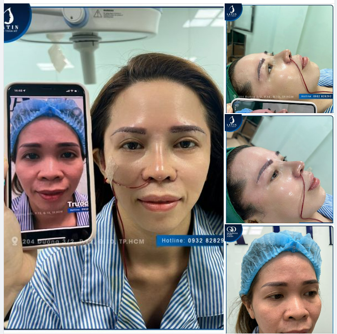 COMBO TRẺ HÓA - NÉT ĐẸP RẠNG NGỜI