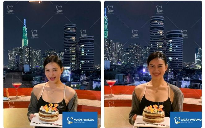 Nắng mưa là chuyện của trời. Niềng răng mà đẹp là do Diễm Quỳnh đã kiên trì suốt 2 năm qua
