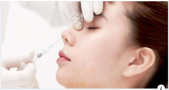 Trên thị trường làm đẹp hiện nay, Tiêm Filler là một trong những dịch vụ luôn được quảng cáo rầm rộ ở bất cứ cơ sở làm đẹp nào dù lớn hay nhỏ.