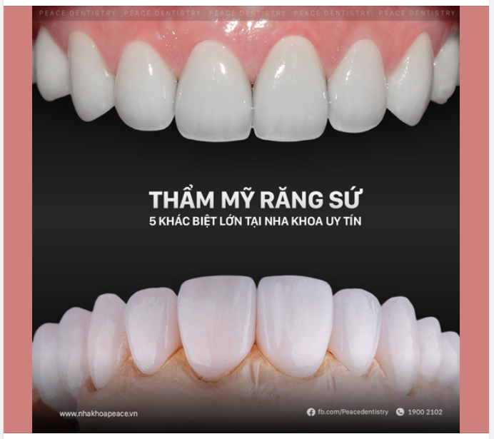 5 SỰ KHÁC BIỆT KHI LÀM RĂNG SỨ VỚI BÁC SĨ GIỎI TẠI NHA KHOA UY TÍN