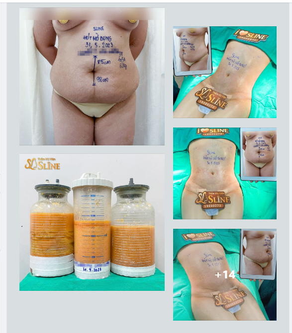 5,7 LÍT MỠ TỪ ĐÂU MÀ RA ?