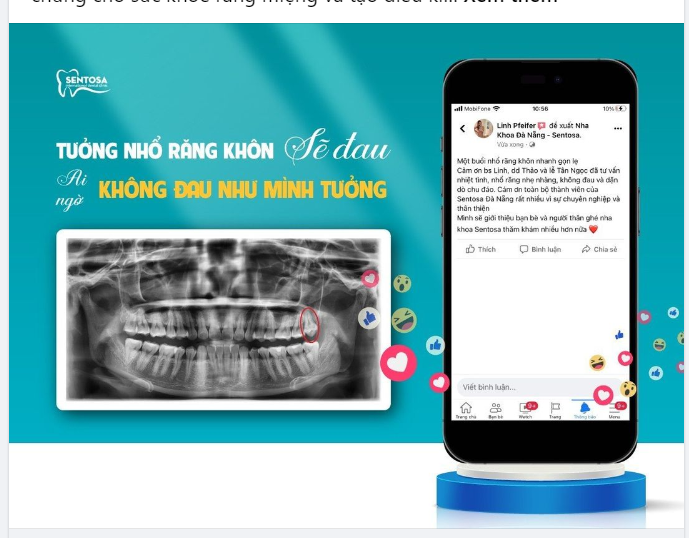 GÓC FEEDBACK  "TƯỞNG NHỔ RĂNG KHÔN SẼ ĐAU, AI NGỜ KHÔNG ĐAU NHƯ MÌNH TƯỞNG"