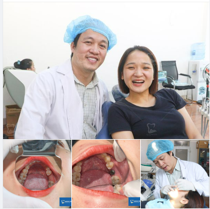 “Bạn này chắc nhà giàu, được ăn kẹo nhiều nên sâu răng” - Bác sĩ Giang nói đùa với bạn Hồng Nhung trước khi cô gái này chuẩn bị cắm trụ implant.