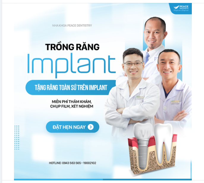 TRỒNG RĂNG IMPLANT CÙNG BÁC SĨ CHUYÊN GIA  NHẬN ƯU ĐÃI ĐẶC BIỆT: Tặng Răng Toàn Sứ Trên Implant