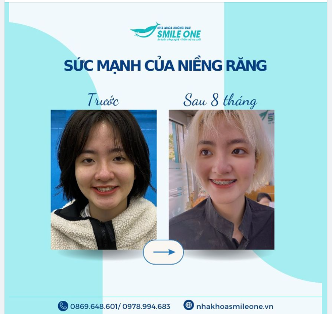 Sự xinh đẹp này cần được lan tỏa tới các đồng niềng!