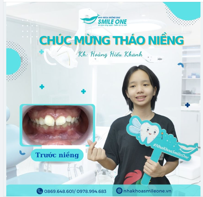 Chúc mừng bạn Hoàng Hiếu Khanh đã tháo niềng thành công!