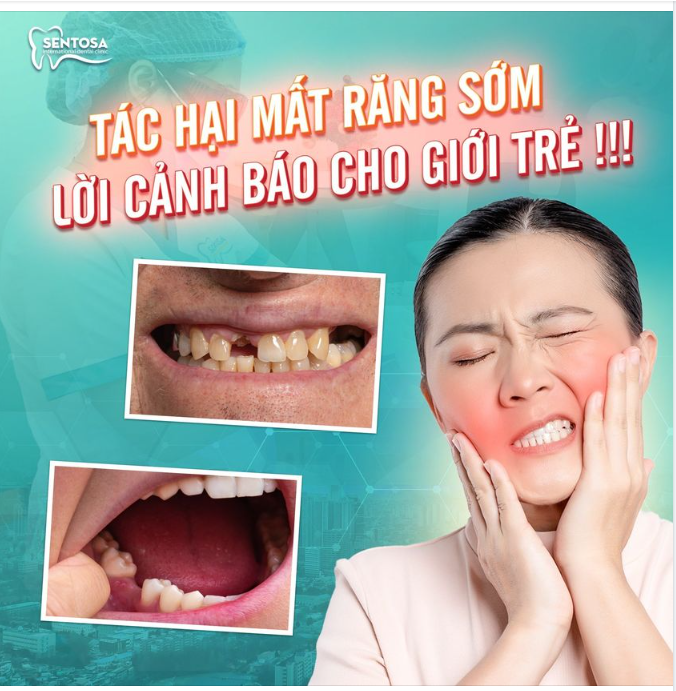 MẤT RĂNG SỚM - LỜI CẢNH BÁO CHO GIỚI TRẺ !!!