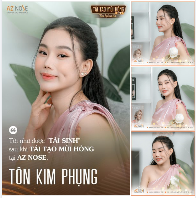 Gần như "mất-tất-cả" chỉ vì chọn nhầm nơi nâng mũi...