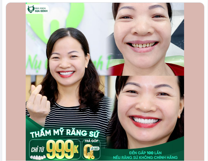 XÓA SỔ​​​​​​​ HÀM RĂNG NHIỄM MÀU KHÁNG SINH CÙNG THẨM MỸ RĂNG SỨ
