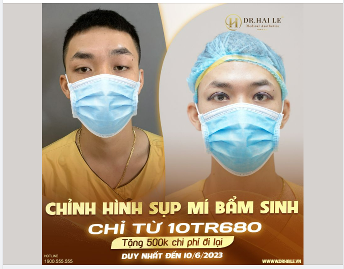 Hầu hết các ca sụp mí bẩm sinh đến với Dr.Hải Lê đều trong tình trạng tâm lý tự ti về ngoại hình, ngại giao tiếp.