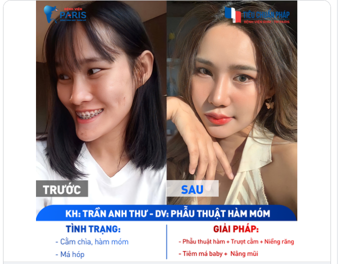 HÃY TRAO CHO TÔI THANH XUÂN CỦA BẠN, TÔI SẼ GIÚP BẠN BIẾN NÓ TRỞ NÊN RỰC RỠ
