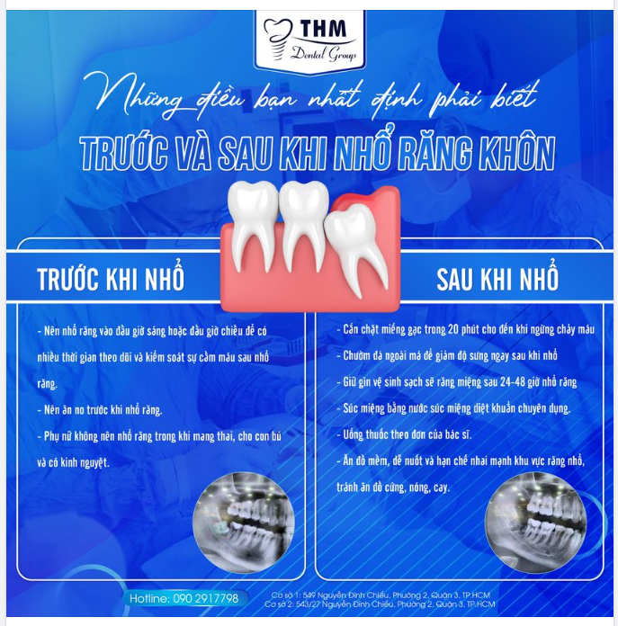 NHỮNG LƯU Ý TRƯỚC VÀ SAU KHI NHỔ RĂNG KHÔN