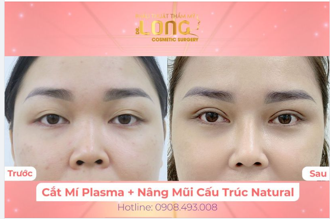 THÁNG 7 TỎA SÁNG CÙNG COMBO MẮT MŨI