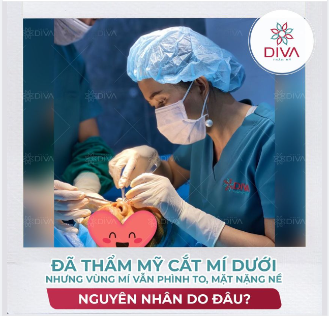 ĐÃ TRẢI QUA THẨM MỸ CẮT MÍ MẮT DƯỚI NHƯNG VÙNG MÍ DƯỚI VẪN PHÌNH TO, MẶT NẶNG NỀ - NGUYÊN NHÂN LÀ GÌ?
