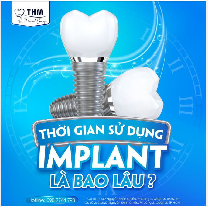 CẤY GHÉP IMPLANT CÓ SỬ DỤNG VĨNH VIỄN ĐƯỢC KHÔNG?