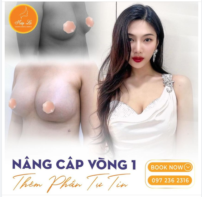 NÂNG CẤP VÒNG 1 THÊM PHẦN TỰ TIN