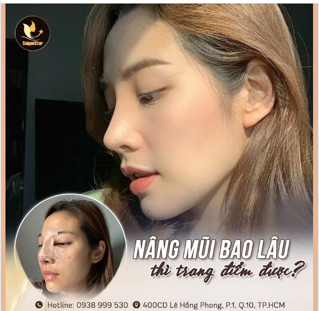 NÂNG MŨI XONG BAO LÂU THÌ ĐƯỢC TRANG ĐIỂM?