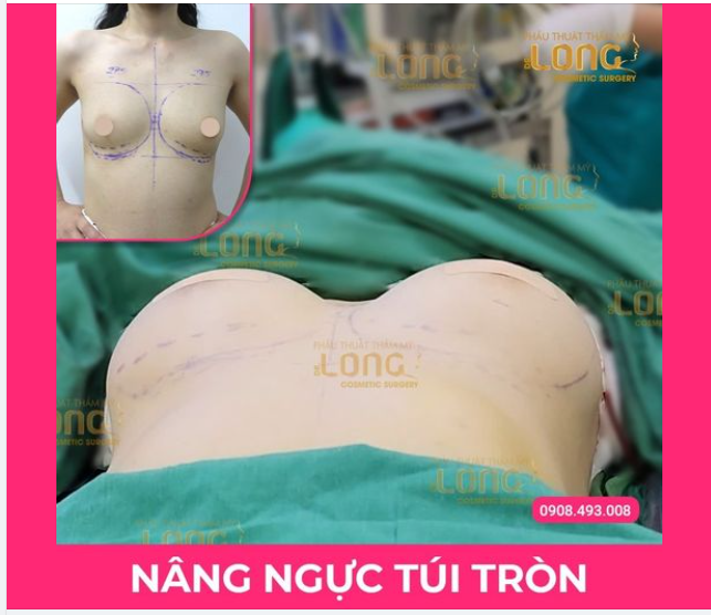 VÒNG 1 BỐC LỬA - MỞ CỬA TRÁI TIM