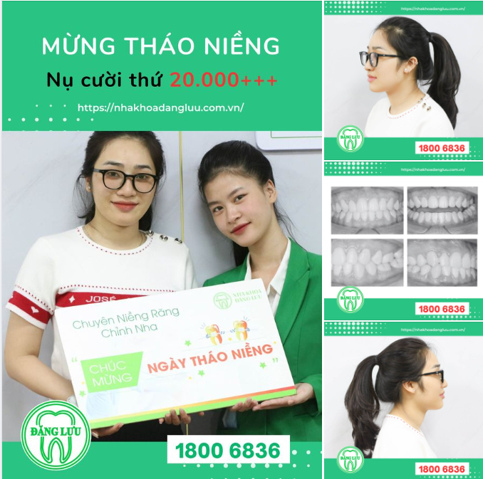 CHUYÊN MỤC THÁO NIỀNG