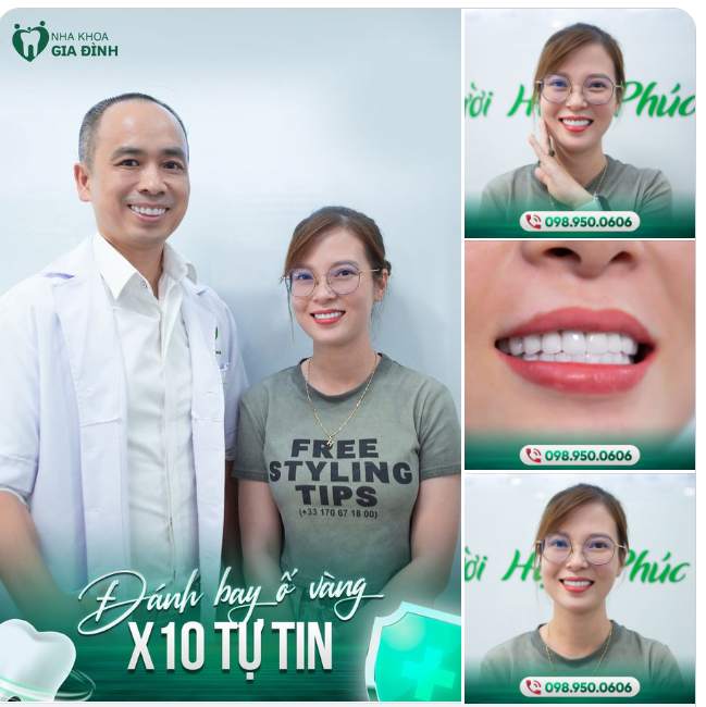 ĐÁNH BAY Ố VÀNG - X10 SỰ TỰ TIN VỚI THẨM MỸ RĂNG SỨ
