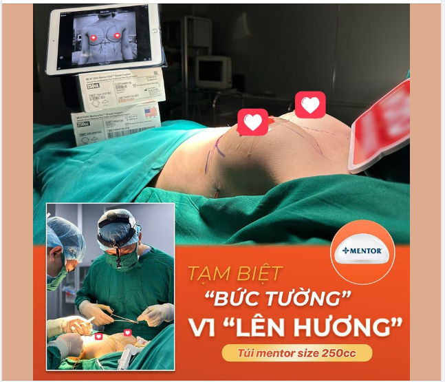 TẠM BIỆT "BỨC TƯỜNG' - V1 "LÊN HƯƠNG"