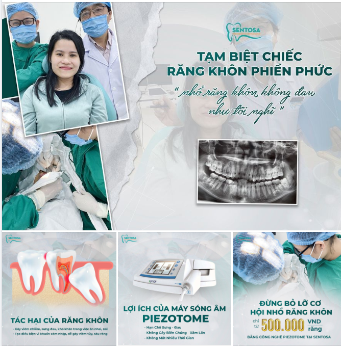 TẠM BIỆT CHIẾC RĂNG KHÔN PHIỀN PHỨC