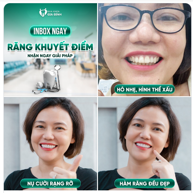 ĐẶT LỊCH NHẬN GIẢI PHÁP TỪ CHUYÊN GIA CHO HÀM RĂNG CỦA BẠN