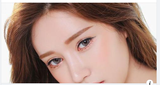 Nâng mũi sụn nhân tạo là phương pháp nâng mũi vô cùng phổ biến và luôn nằm trong top những dịch vụ thẩm mỹ được lựa chọn nhiều nhất hiện nay.