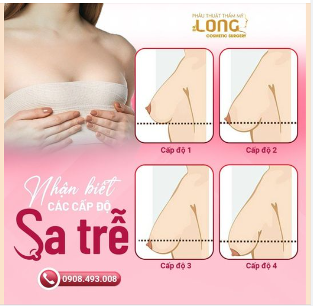 NHẬN BIẾT CÁC CẤP ĐỘ SA TRỄ