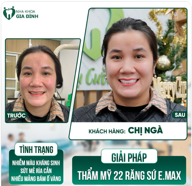 THAY ĐỔI NỤ CƯỜI - BỘI PHẦN TỰ TIN
