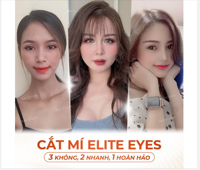 CẮT MÍ ELITE EYES - 3 KHÔNG, 2 NHANH, 1 HOÀN HẢO