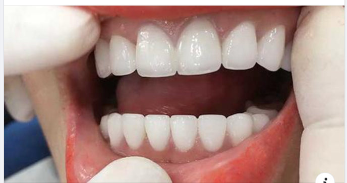 10 sự thật thú vị về răng miệng