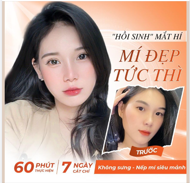 "HỒI SINH" MẮT HÍ - MÍ ĐẸP TỨC THÌ